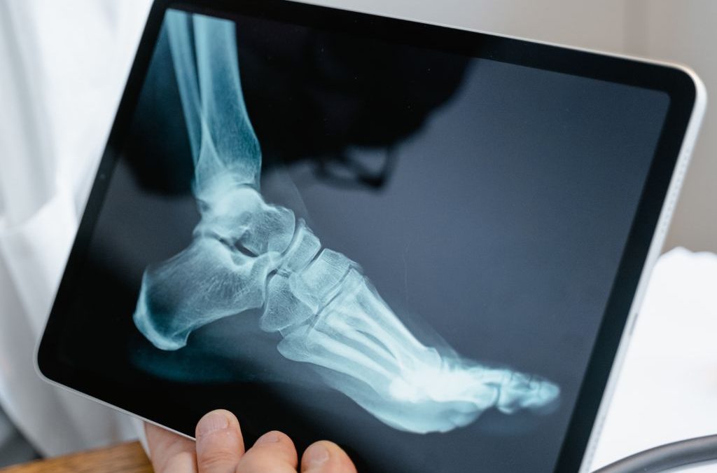 Día 8 de noviembre: Día Mundial de la Radiología